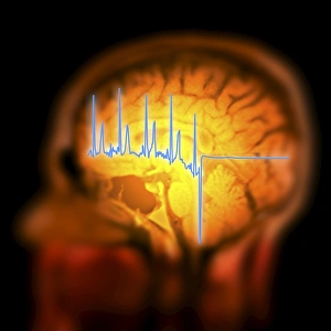 Drucke von Der Gehirn anatomy . Farbiges Magnetresonanztomographie -Scan der menschlichen Kopf von oben und seitlich. Die saggitale Scan hat das Gehirn halbiert , die innere Anatomie zu zeigen Bilder Datiert 2012 Juni: EKG-Trace und MRI-Brainscan als Kunstwerk