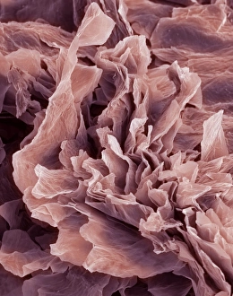 Drucke von Eczem ist eine Form der Dermatitis oder einer Entzündung der oberen Schichten des Hauts Bilder Datiert 2008 August: Atopische Ekzeme, SEM