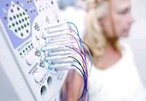 Electroencephalography