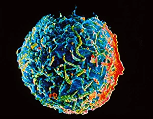 Immune System Cells Drucke: Electron micrograph of B-lymphocyte blood cell