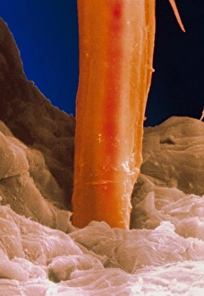 Bilder, datiert 1995: Elektronenmikroskopbild von Katzenfleckenstilz im Haut