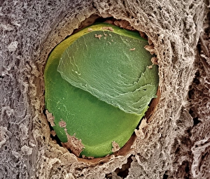 Coloured SEM Images Drucke: Embolism
