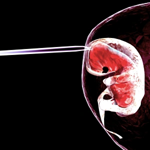 Drucke von Embryoforschung. Computerkunstwerk einer Nahtuchel im Amnionsack eines menschlichen Embryos Bilder Datiert 2005 Januar: Embryonenforschung