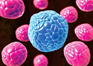 Drucke von Endometriosis ist eine Krankheit der Eierstöcke und des Gebärmutterhalses Bilder Datiert 2007 November: Endometriosen, Computerkunstwerk