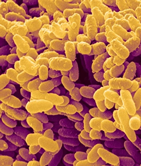 SEM Images Of Bacteria Drucke: Erwinia bacteria, SEM