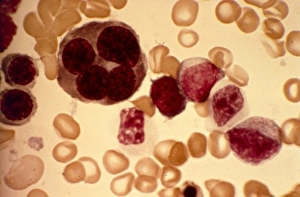 Light Micrograph Images Drucke: Erythroblast blood cell, light micrograph