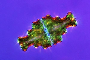 Polarised Light Microscopy Drucke: Euastrum desmids, light micrograph