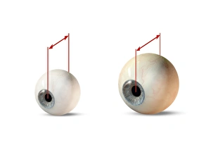 Anatomy Of The Human Eye Drucke: Eye size comparison, artwork
