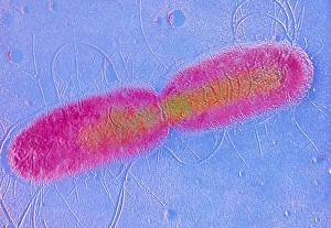 Bilder aus dem Jahr 1991: Eiweißschatten von F/col-TEM-Bildung bei der Teilen von E.-coli