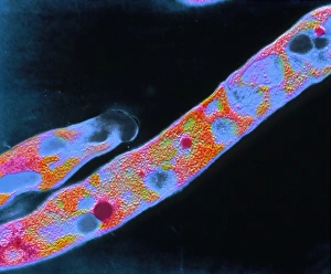 Bilder aus dem Jahr 1991: Coli-Form von Mycobakterium tuberkulose