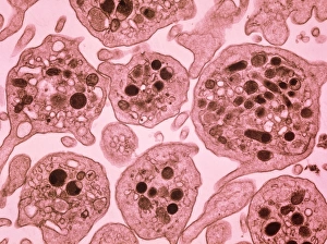 Human Anatomy Images Drucke: F / col TEM of section through blood platelets