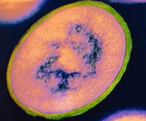 Staphylococcus Aureus Bacteria Drucke: F / col TEM of Staphylococcus aureus