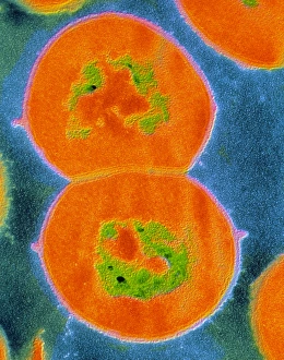 Drucke von Streptokokus viridianer Bilder Datiert 2003 Januar: Stäbchen von Streptococcus viridans