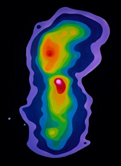 Bilder aus dem Jahr 1985: Falschfarbige Kollektionsradio-Karte der aktiven Galaxie Zentauruspunkt A