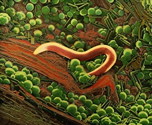 Bilder aus dem Jahr 1989: Falsche Kolonie-Sem von Nematodenwurm auf Probenahme von Torf.