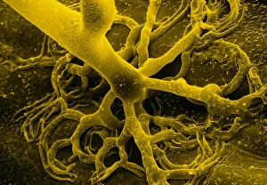 Bilder aus dem Jahr 1987: Falsche Kolonie-SEM von Rhizoiden.