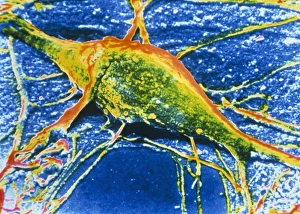 Human Nervous System Anatomy Drucke: False-col SEM of single neurone of cerebral cortex