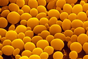 Saccharomyces Cerevisiae Micrograph Drucke: False-col SEM of yeast cells