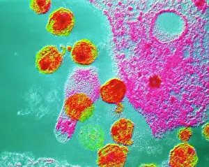 Bilder, datiert 2004: Falschkollektiver TEM-Bild von HIV-Virus im Zellzweig
