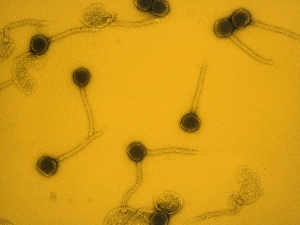 Virology Images Drucke: False-col TEM of Lambda bacteriophages
