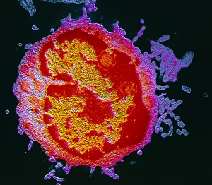 Bilder aus dem Jahr 1989: Falschkolortem von einem Lymphozyten