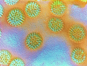 Drucke von Falschfarbendes Transmissionselektronenmikroskopbild (TEM) von Rotaviren (Viruspartikel). Einzelne Viren bestehen aus einem Proteinkapsid um einen Kern mit doppelsträngigem RNA Bilder Datiert 2003 Oktober: Falschkolortem von Rotavirusppartikeln