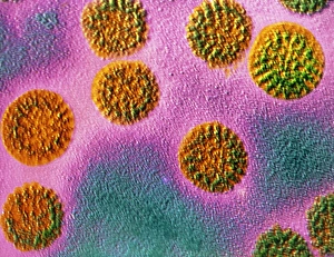 Transmission Electron Micrograph Drucke: False-col TEM of rotaviruses