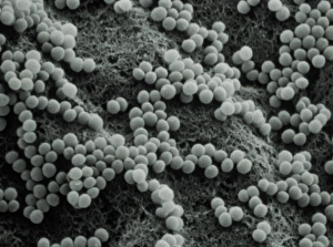 Staphylococcus Aureus Bacteria Drucke: False-col TEM of Staphylococcus aureus
