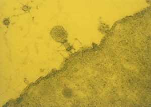 Bilder aus dem Jahr 1985: Falschkolonale TEM-Präparat des T4-Bakteriophages bei Escherichia coli