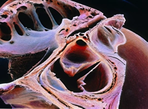 Drucke von Herzklappe, falschfarbige Rastertonenmikroskopie der aortalen Klappen (Mitte unten) Bilder Datiert 2003 September: Falschfarbener SEM-Bild des Aortenvalves