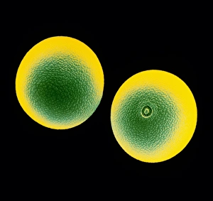 Hay Fever Causes Drucke: False-colour SEM of cocksfoot grass