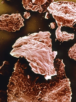 Human Skin Anatomy Drucke: False-colour SEM of dandruff