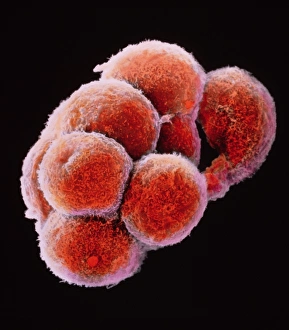 Bilder aus dem Jahr 1992: Falschfarbener SEM-Bild von Embryo bei der Morula-Stufe