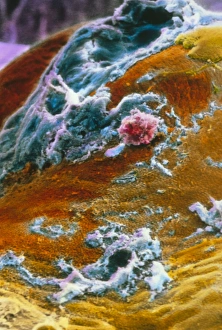 Drucke von Die Oberfläche der Eierstöcke bei Ovulation. Falschfarbendes Rasterelektronenmikroskopbild der Oberfläche des Eierstocks etwa eine Stunde nach der Ovulation Bilder Datiert 2002 Juni: Falschfarbener SEM-Bild des menschlichen Ei nach Ovulations