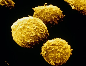 Bilder aus dem Jahr 1986: Falschfarbener SEM-Bild von menschlichen T-Lymphozyten