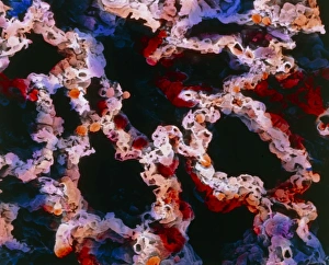 Lung Anatomy Drucke: False-colour SEM of a section of lung tissue