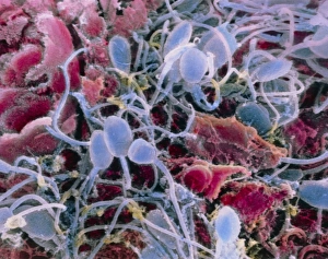 Reproductive Biology Images Drucke: False-colour SEM of sperm on a human egg