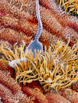 Drucke von Sperma im Uterus. Falschfarbendes Rasterelektronenmikroskopbild eines menschlichen Spermiums auf der innern Oberfläche des Gebärmutterhutes, dem Endometrium Bilder Datiert 2004 Juni: Falschfarbene SEM-Bildung von Spermien im Uterus