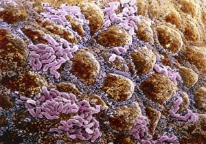 False Coloured SEM Images Drucke: False-colour SEM of wall of colon, with bacteria