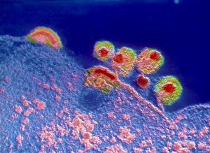 False Colour TEM Images Drucke: False colour TEM of AIDS virus