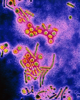 Bilder aus dem Jahr 1992: Falschfarbendes TEM-Bild des HEPATITIS-B-Virus
