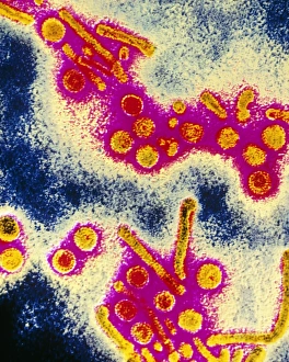 Bilder aus dem Jahr 1992: Falschfarbendes TEM-Bild von Hepatitis B-Virenpartikeln