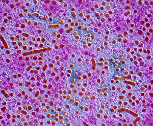 Virology Images Drucke: False-colour TEM of hepatitis B viruses