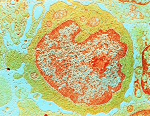 Bilder aus dem Jahr 1988: Falschfarbendes TEM-Bild eines menschlichen Lymphozyten