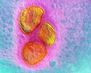 Drucke von Falschfarbener Transmissionselektronenmikroskopbild (TEM) von drei Virionen (Viruspartikeln) der Mumpsviren (einem Mitglied der Paramyxoviridae-Virusfamilie) Bilder Datiert 2002 November: Falschfarbendes TEM-Bild von Mumpsviruspartikeln