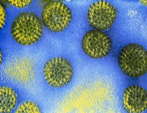 RNA Virus Drucke: False-colour TEM of rotavirus particles