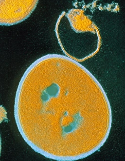 Drucke von Farbige Transmissionselektronenmikroskopaufnahme (TEM) von Bakterien Staphylococcus aureus mit einem vollen Bakterium im Mittelpunkt und dem anderen unter Zerstörung durch Antibiotika Bilder Datiert 2003 Februar: Falschfarbendes TEM-Bild von Staphylococcus aureus