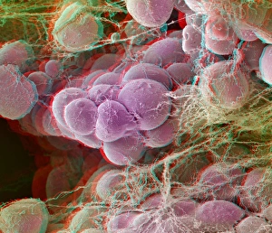 Bilder vom 7. März 2013: Fettgewebe, Stereokopplikatives SEM
