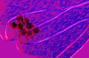 Light Microscopy Images Drucke: Fern spore cases, light micrograph