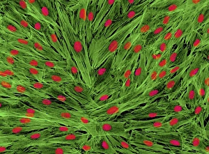 Light Micrograph Images Drucke: Fibroblast cells, light micrograph